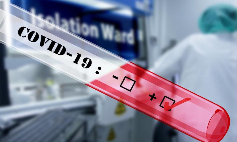 Diabetes mellitus a COVID-19. Význam správnej výživy a pohybu pri redukcii rizika a dôsledkov ochorenia. 